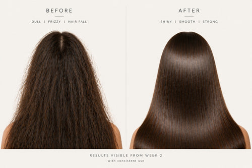 Hard Water Shampoo for mineral buildup removal & scalp detox